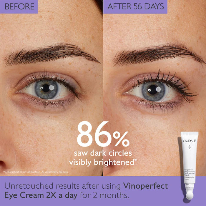 Caudalie
Vinoperfect Dark Circle Brightening Eye Cream with Niacinamide