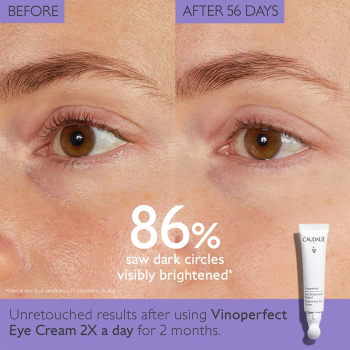 Caudalie
Vinoperfect Dark Circle Brightening Eye Cream with Niacinamide